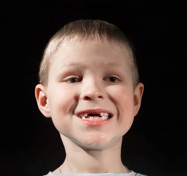Lindo chico falta algunos dientes delanteros —  Fotos de Stock