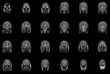 Magnetic resonance imaging MRI of brain stem clipart