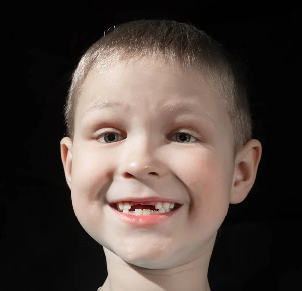 Netter Junge, dem einige Vorderzähne fehlen — Stockfoto