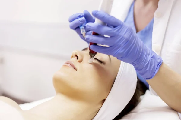 Mesotherapy with an Intradermal Hyaluronic Acid Formulation for Skin Rejuvenation — Stock Photo, Image