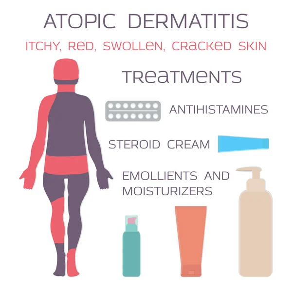 Dermatite atopique, eczéma. Les médicaments sont des comprimés antihistaminiques et des crèmes stéroïdes . — Image vectorielle