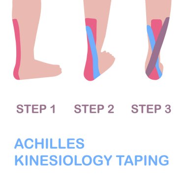 Achilles kinesiology taping.  clipart