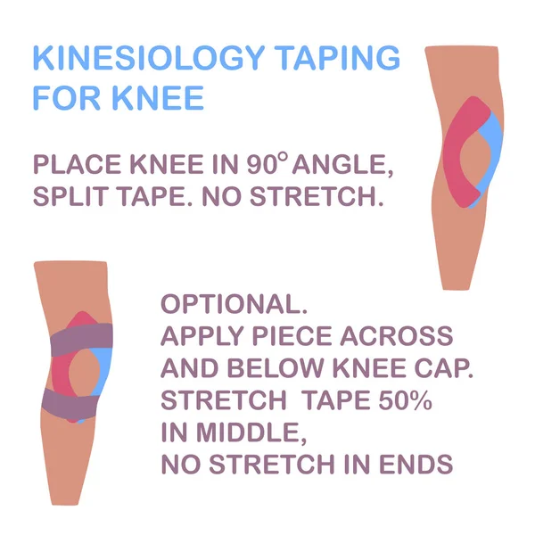 Кінезіологія для коліна. Без стретч-стрічки . — стоковий вектор