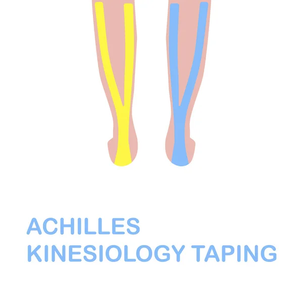 Achilles Kinesiyoloji kaydediyor. Kinesiyoloji taping düzeltmek. — Stok Vektör