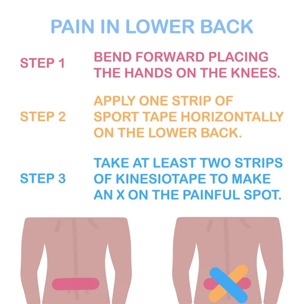 Боль в пояснице. Правильная кинезиологическая лента . Лицензионные Стоковые Иллюстрации