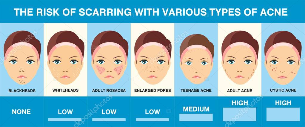 Acne scars. Different types of acne. Infographics. Skin problems
