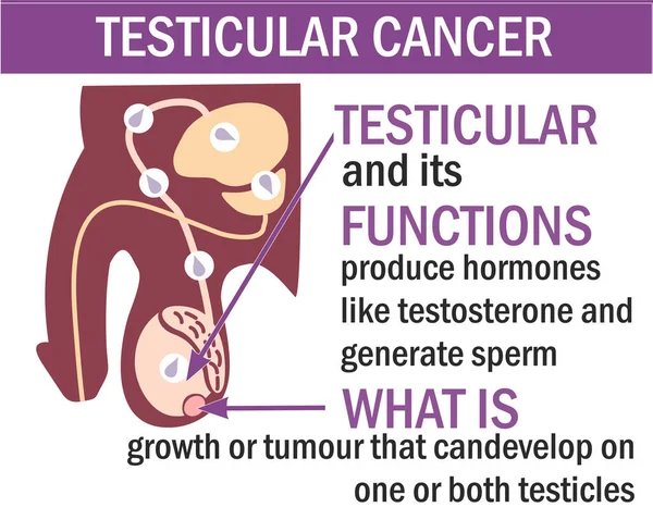 Uma anatomia masculina da ilustração do câncer testicular. Infográficos de câncer testicular . —  Vetores de Stock