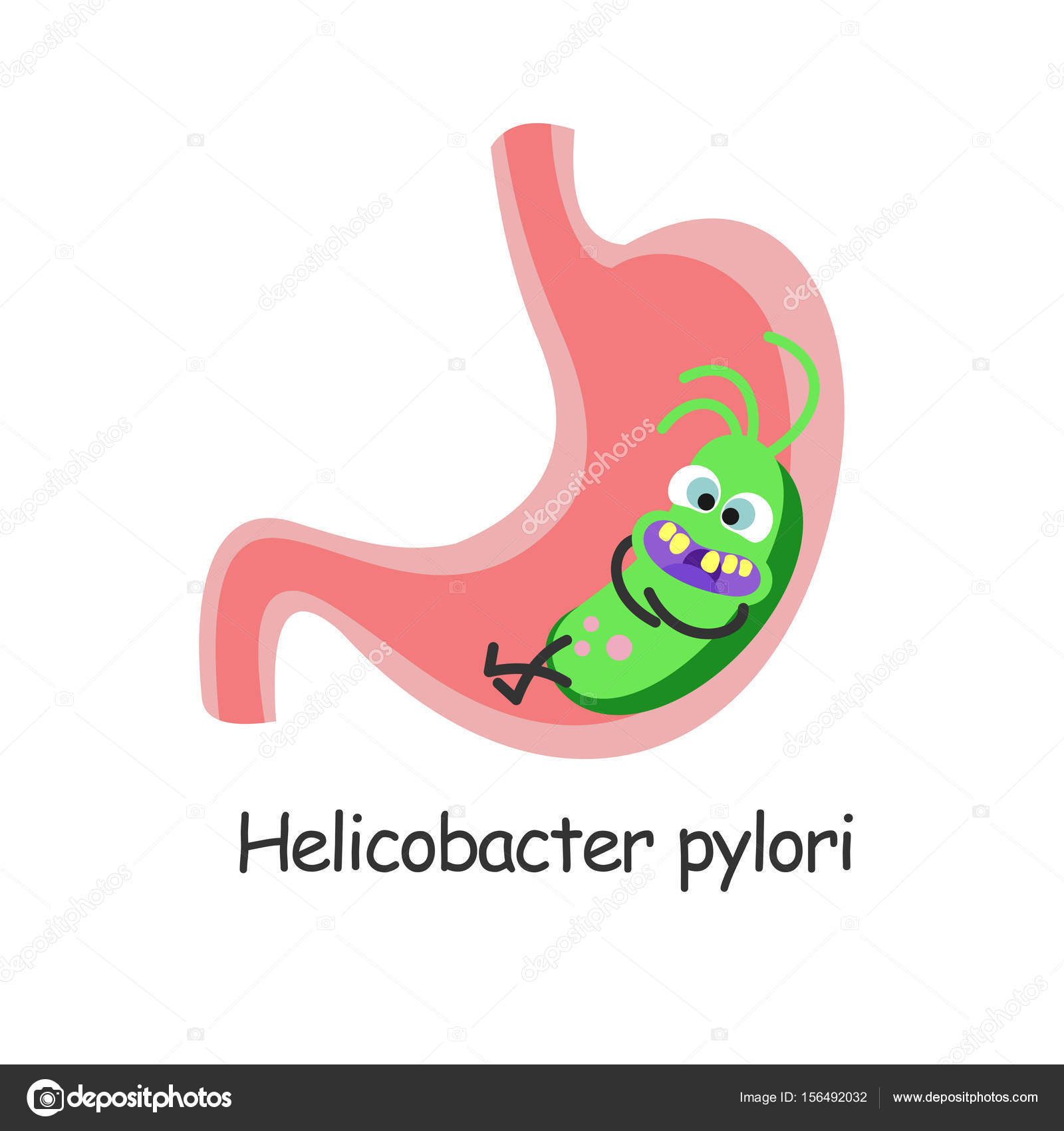 helicobacter pylori baktériumok szemölcsök rosszindulatúak
