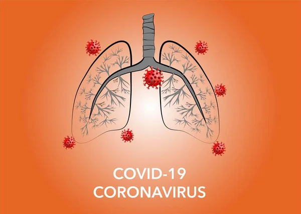 Crisi Coronavirica Infezioni Tutto Mondo — Vettoriale Stock