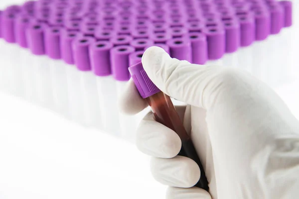 Edta Blood Tube Cbc Test Laboratory — Stock Photo, Image