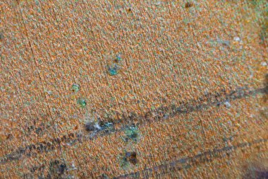 NFC yongası mikroskop altında