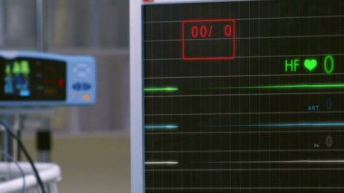 Cinemagraph darbe darbe E.C.G monitör denetimi