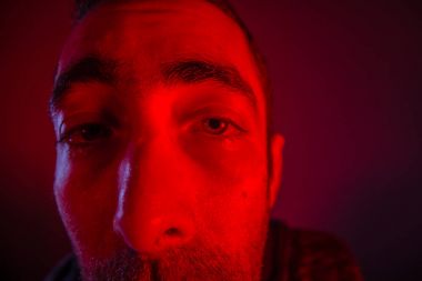 Hasta ya da sarhoş adam terleme baktı