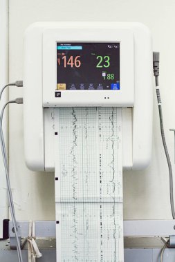 Bebeğin kalp atışlarını, elektrokardiyografisini ve doğum ve doğum odasındaki ana rahmini kapatın..