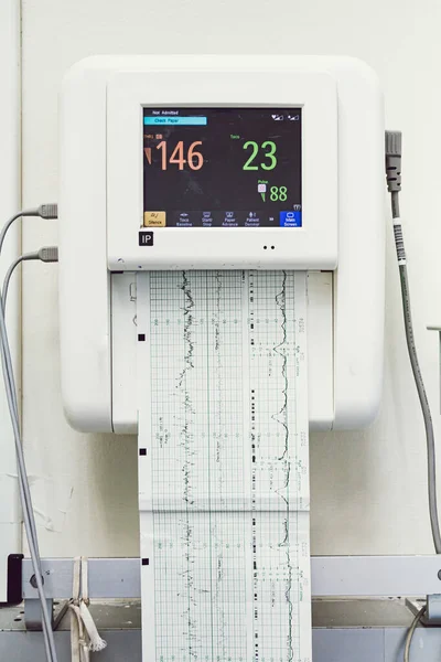 Gros Plan Moniteur Fœtal Une Impression Sans Stress Pouls Électrocardiographie — Photo