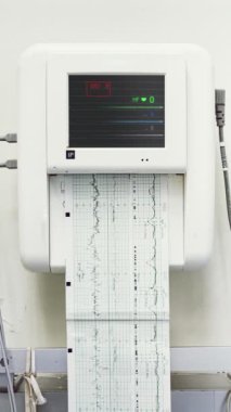 Hastanenin koğuşundaki bir fetal monitörün sineması. Bebeğin kalp atışlarını baskılama testini kapat. Elektrokardiyogram monitöründe kalp atışı yok..