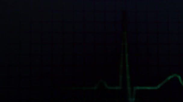 Ekg Abstrakt Hud Vorlage Für Die Herzschlaglinie Kardiogrammmonitor — Stockvideo