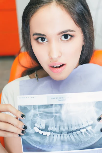 Patient asian girl holding x-ray picture of her teeth — Stock Photo, Image