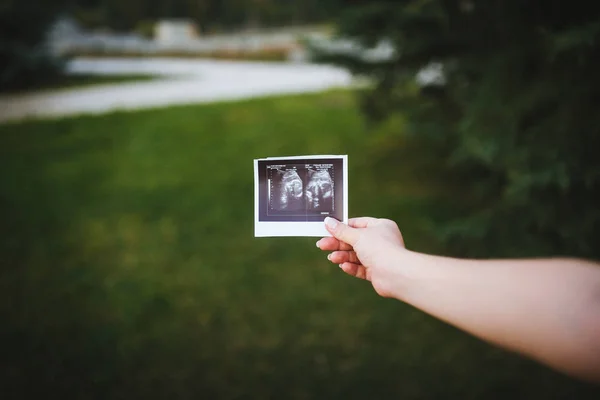 Ultrasound scan of baby in hands on green bakcground — Stock Photo, Image