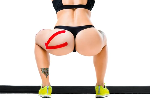 The concept of sports medicine,sticky tape kinesiology tape on the skin for the treatment of muscle injury and tendon in athletes.Sexy girl in bikini squats her back inflated beautiful asshole — Stockfoto