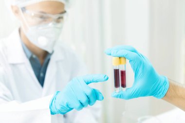 Araştırmacılar laboratuvarda hastalığa yakalanan hastaların kan örneklerini karşılaştırıyorlar. Araştırmacılar COVID-19 virüsünü tedavi etmek için aşı icat ediyorlar..