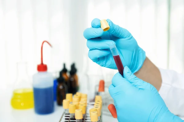 Onderzoekers Testen Bloedmonsters Het Laboratorium Onderzoekers Bedenken Vaccins Voor Behandeling — Stockfoto