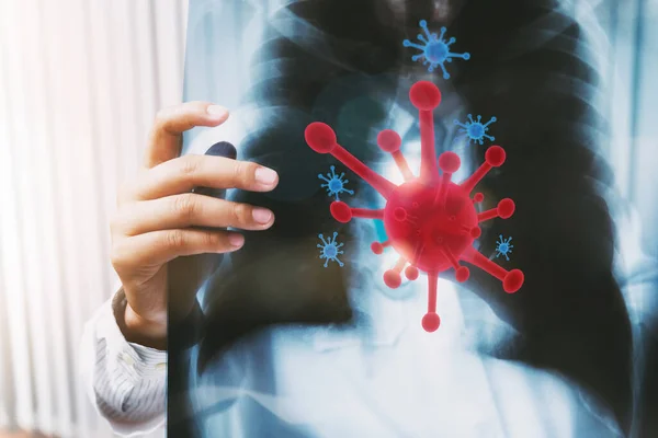 Bir doktor, koronavirüs enfeksiyonu olan hastaların akciğer röntgenlerinin sonuçlarını teşhis ediyor..