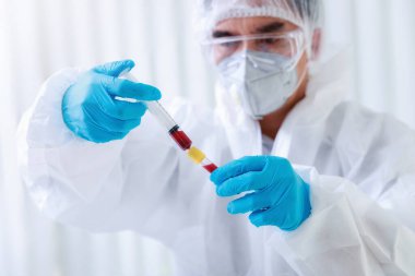 Araştırmacı ya da bilim adamı kan örneklerini laboratuardaki test tüpüne yükler. Araştırmacılar COVID-19 virüsünü tedavi etmek için aşı icat ediyorlar..