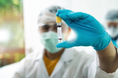 Araştırmacılar kan örneklerini laboratuvarda test ediyorlar. Araştırmacılar COVID-19 virüsünü tedavi etmek için aşı icat ediyorlar..