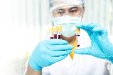 Araştırmacılar laboratuvarda hastalığa yakalanan hastaların kan örneklerini karşılaştırıyorlar. Araştırmacılar COVID-19 virüsünü tedavi etmek için aşı icat ediyorlar..