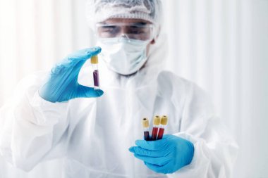Araştırmacılar kan örneklerini laboratuvarda test ediyorlar. Araştırmacılar COVID-19 virüsünü tedavi etmek için aşı icat ediyorlar..