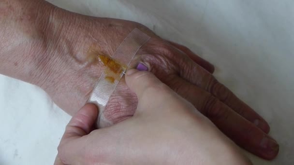 Medizinische Injektion in die Hand des Patienten. — Stockvideo
