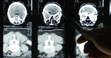 4 k Doktorlar kafatası beyin röntgen filmi analysis.health tıbbi hastane için çalışma.