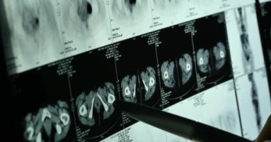 4 k Doktorlar kafatası beyin röntgen filmi analysis.health tıbbi hastane için çalışma.