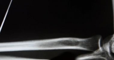 4 k doktorlar dokunmatik ekran eq çözümleme için kol, bacak ve palm eklem röntgen film eğitimi