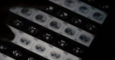 4 k doktor işletim Ct röntgen film analizi için dokunmatik ekran ipad app yazılımı