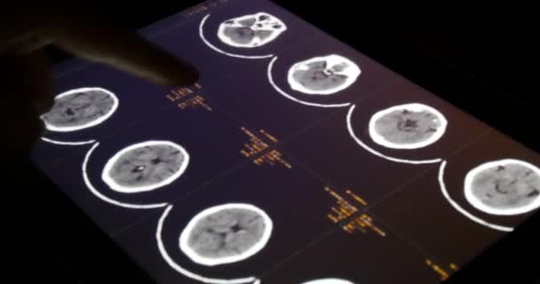 4k Doctor touch PET-CT película de rayos X en pantalla táctil ipad aplicación de software para el análisis — Vídeo de stock