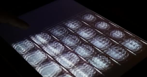 4k Doctor touch PET-CT X-ray film sur écran tactile ipad app logiciel pour l'analyse — Video