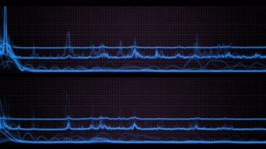 4 k borsa trend analiz istatistik verileri kalp atışı darbe EKG kılavuz çizgileri.
