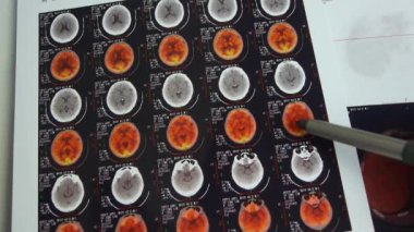 Doktor çalışma renk baş pet-BT, kafatası beyin X-ray.