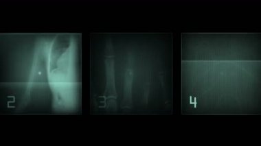 4 k insan parmağı kemik taraması, teknoloji tıbbi X-ray veri, tıbbi araştırma vücut sağlığı.