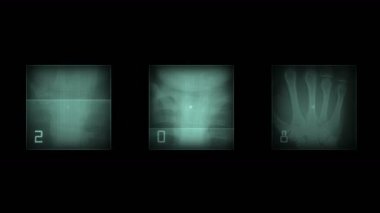 4 k insan parmağı kemik taraması, teknoloji tıbbi X-ray veri, tıbbi araştırma vücut sağlığı.