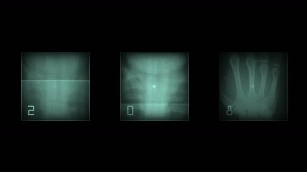 4 k 人类手指骨扫描、 科技医疗 x 射线数据、 医学研究身体健康. — 图库视频影像