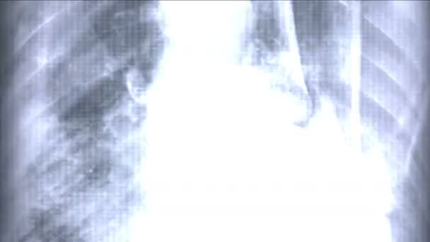 4k Escáner óseo del dedo de la costilla humana, rayos X médicos de tecnología, investigación médica, salud corporal . — Vídeos de Stock