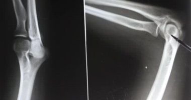 4 k doktorlar kol, bacak eklemleri röntgen filmi analysis.medical sağlık hastane için çalışma