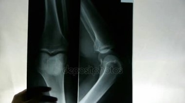 Doktorlar kol, bacak ve palm eklem X-ray film analizi eğitimi.