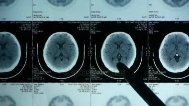 Çin-Eyl 08, 2016:doctor çalışma baş pet/ct tarama analizi için hastalığı, kafatası beyin X-ray.