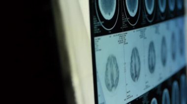 Doktor çalışma baş pet/ct tarama analizi için hastalığı, kafatası beyin X-ray.