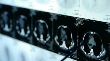 Doktor çalışma meme pet-ct taraması, tıbbi x-ray.