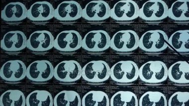 Doktor çalışma akciğer pet-ct taraması, tıbbi X-ray.
